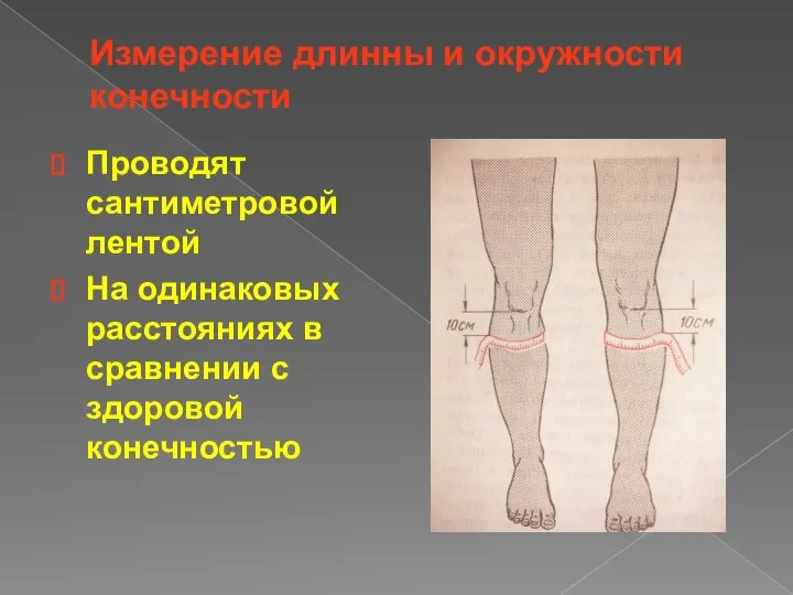 Измерение длинны и окружности конечности Проводят сантиметровой лентой На одинаковых расстояниях в сравнении с здоровой конечностью