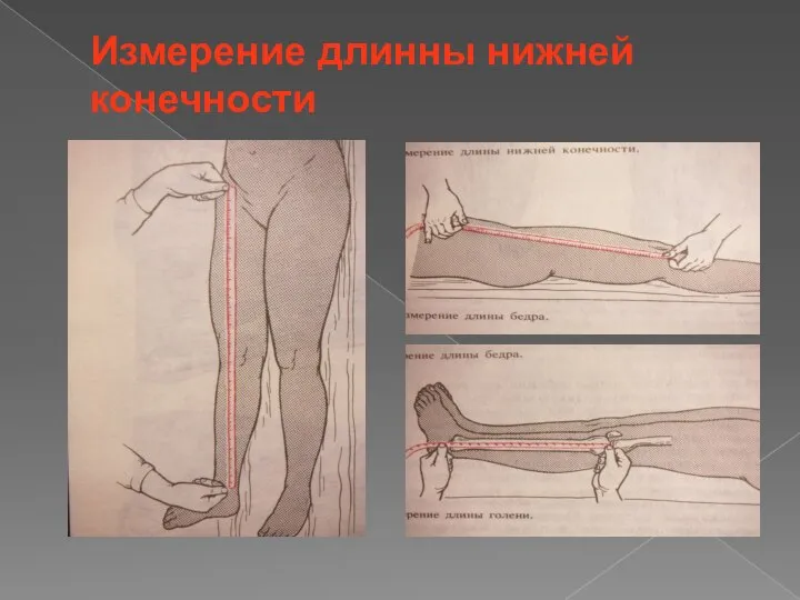 Измерение длинны нижней конечности