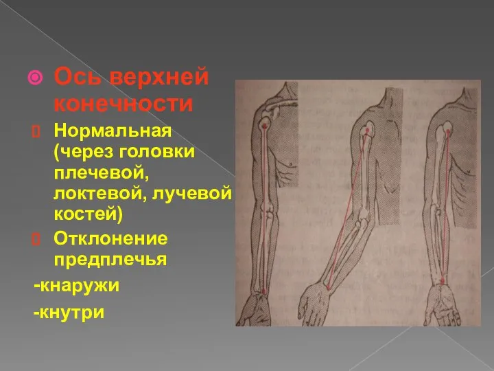 Ось верхней конечности Нормальная (через головки плечевой, локтевой, лучевой костей) Отклонение предплечья -кнаружи -кнутри