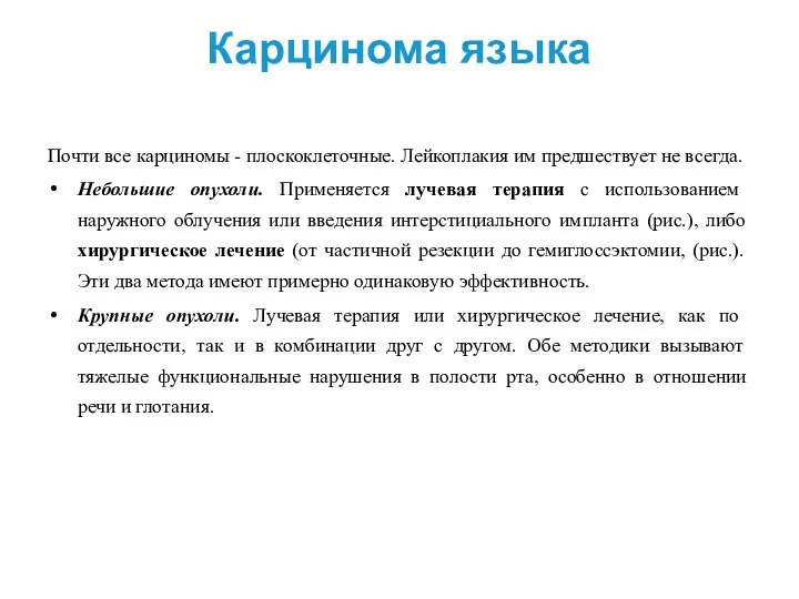 Карцинома языка Почти все карциномы - плоскоклеточные. Лейкоплакия им предшествует не всегда.