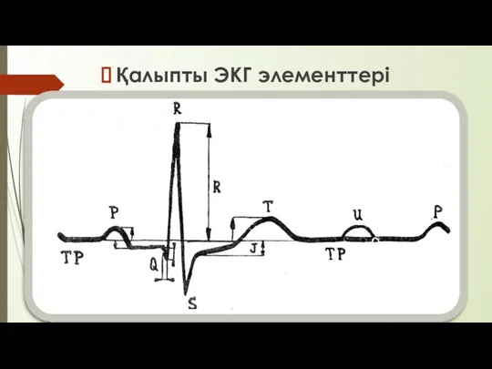 Қалыпты ЭКГ элементтері