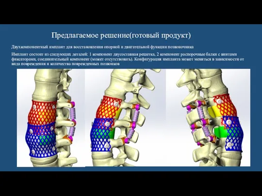 Предлагаемое решение(готовый продукт) Двухкомпонентный имплант для восстановления опорной и двигательной функции позвоночника