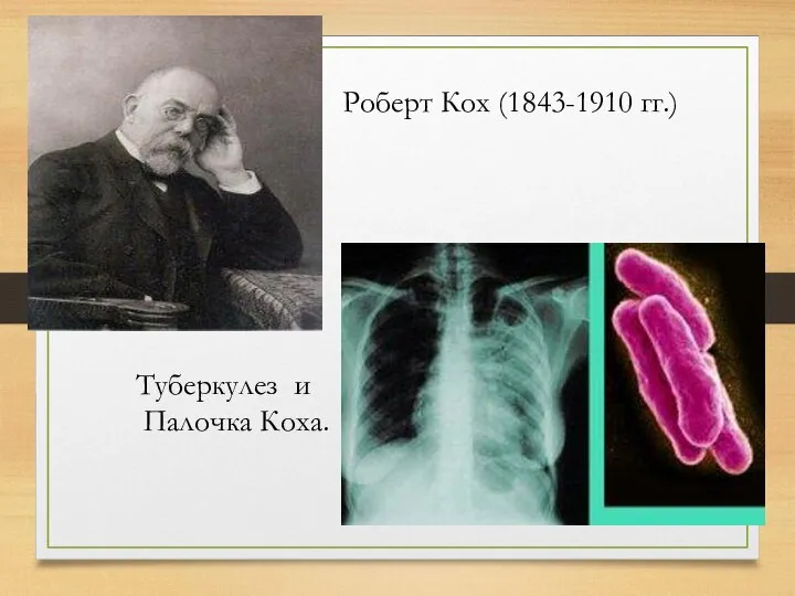 Роберт Кох (1843-1910 гг.) Туберкулез и Палочка Коха.