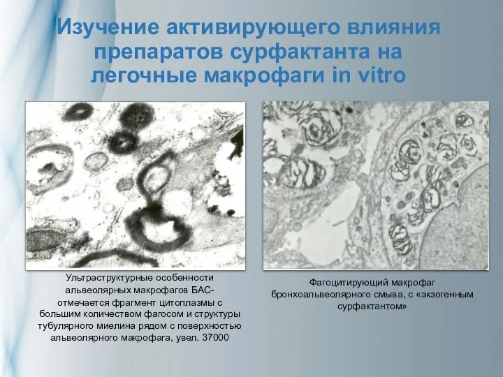 Изучение активирующего влияния препаратов сурфактанта на легочные макрофаги in vitro Ультраструктурные особенности