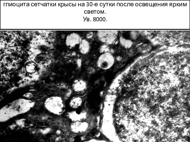Осмиофилия и вакуолизация цитоплазмы радиального глиоцита сетчатки крысы на 30-е сутки после