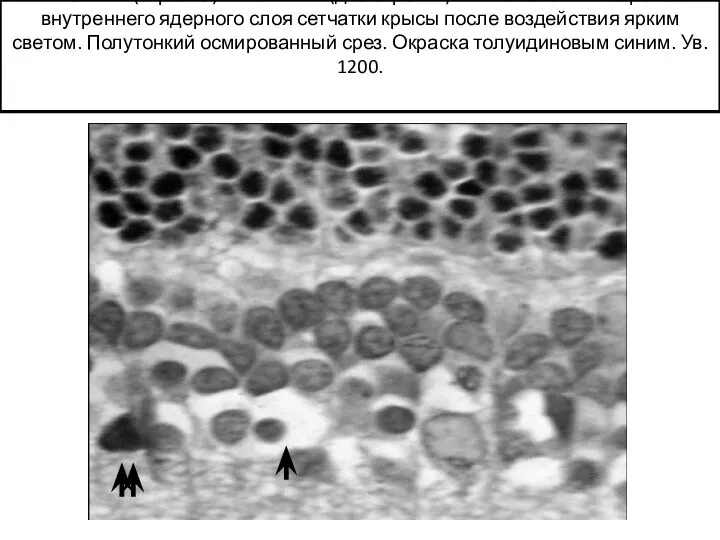"Светлый"(стрелка) и "тёмный" (две стрелки) тип изменения нейронов внутреннего ядерного слоя сетчатки