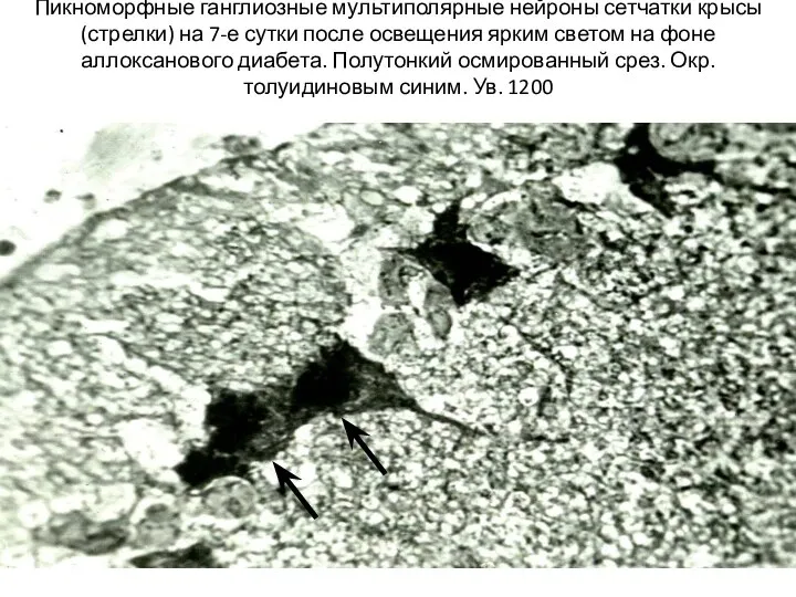 Пикноморфные ганглиозные мультиполярные нейроны сетчатки крысы (стрелки) на 7-е сутки после освещения