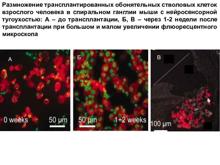 Размножение трансплантированных обонятельных стволовых клеток взрослого человека в спиральном ганглии мыши с