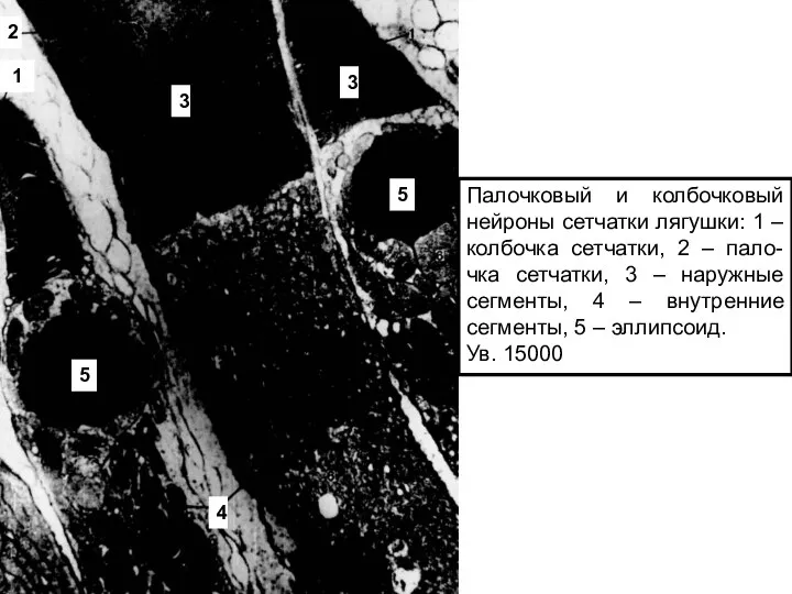 Палочковый и колбочковый нейроны сетчатки лягушки: 1 – колбочка сетчатки, 2 –