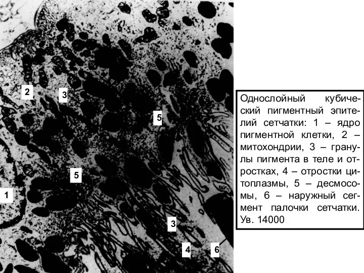 Однослойный кубиче-ский пигментный эпите-лий сетчатки: 1 – ядро пигментной клетки, 2 –