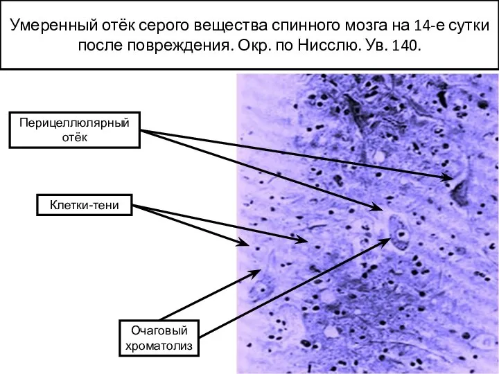 Умеренный отёк серого вещества спинного мозга на 14-е сутки после повреждения. Окр.