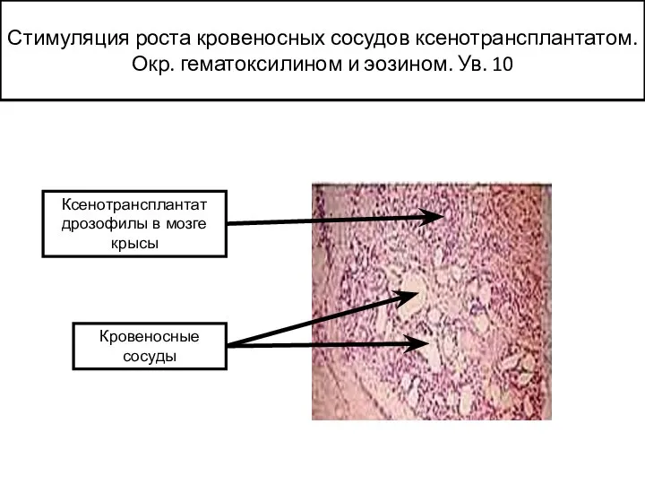 Стимуляция роста кровеносных сосудов ксенотрансплантатом. Окр. гематоксилином и эозином. Ув. 10 Ксенотрансплантат