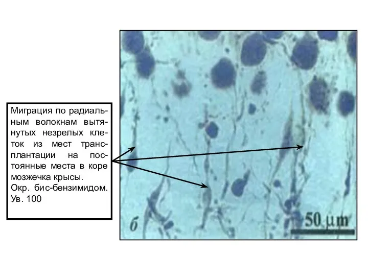 Миграция по радиаль-ным волокнам вытя-нутых незрелых кле-ток из мест транс-плантации на пос-тоянные