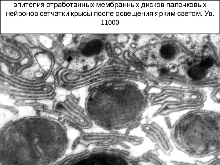 Захват гипертрофированными микроворсинками пигментного эпителия отработанных мембранных дисков палочковых нейронов сетчатки крысы