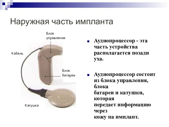 Наружная часть импланта Аудиопроцессор - эта часть устройства располагается позади уха. Аудиопроцессор