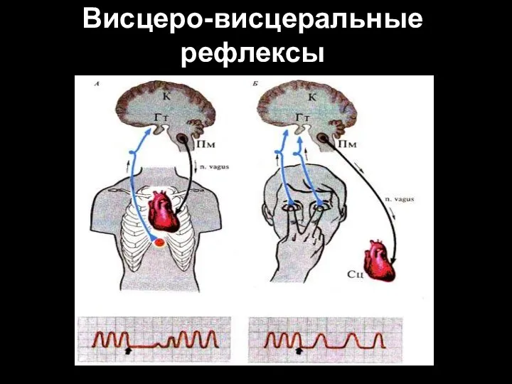 Висцеро-висцеральные рефлексы