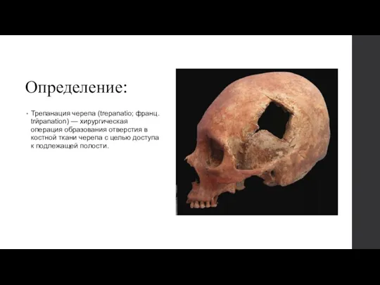 Определение: Трепанация черепа (trepanatio; франц. trйpanation) — хирургическая операция образования отверстия в