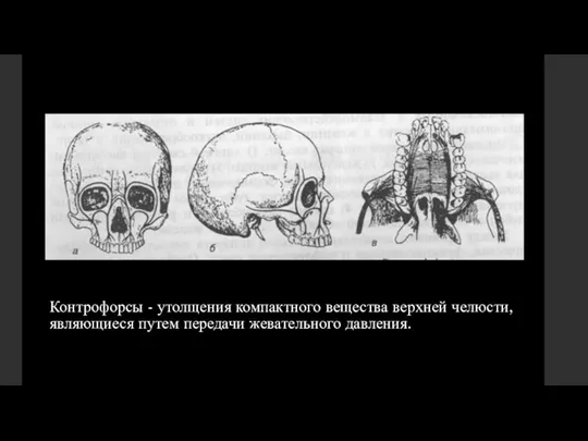 Контрофорсы - утолщения компактного вещества верхней челюсти,являющиеся путем передачи жевательного давления.