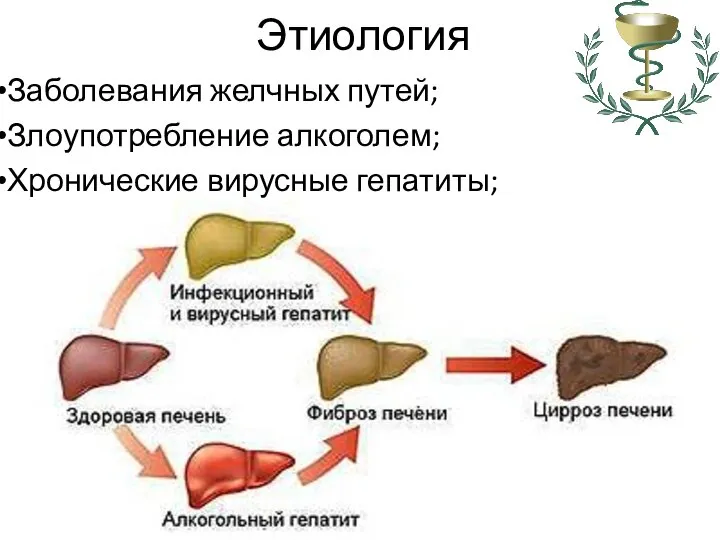 Этиология Заболевания желчных путей; Злоупотребление алкоголем; Хронические вирусные гепатиты;