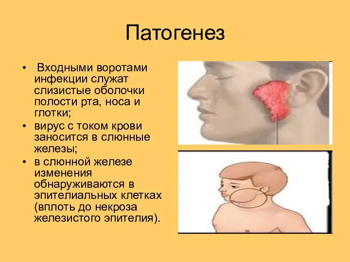 Патогенез Входными воротами инфекции служат слизистые оболочки полости рта, носа и глотки;