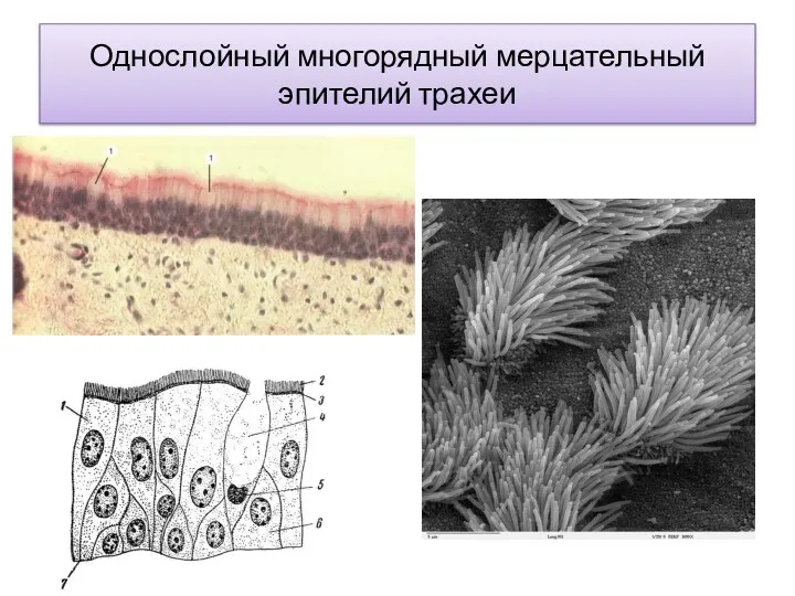 Однослойный многорядный мерцательный эпителий трахеи