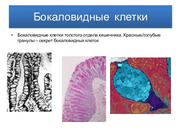 Бокаловидные клетки Бокаловидные клетки толстого отдела кишечника. Красные/голубые гранулы – секрет бокаловидных клеток