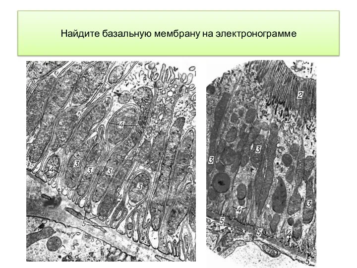 Найдите базальную мембрану на электронограмме