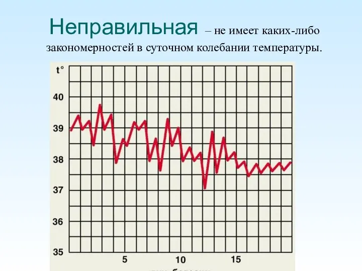 Неправильная – не имеет каких-либо закономерностей в суточном колебании температуры.