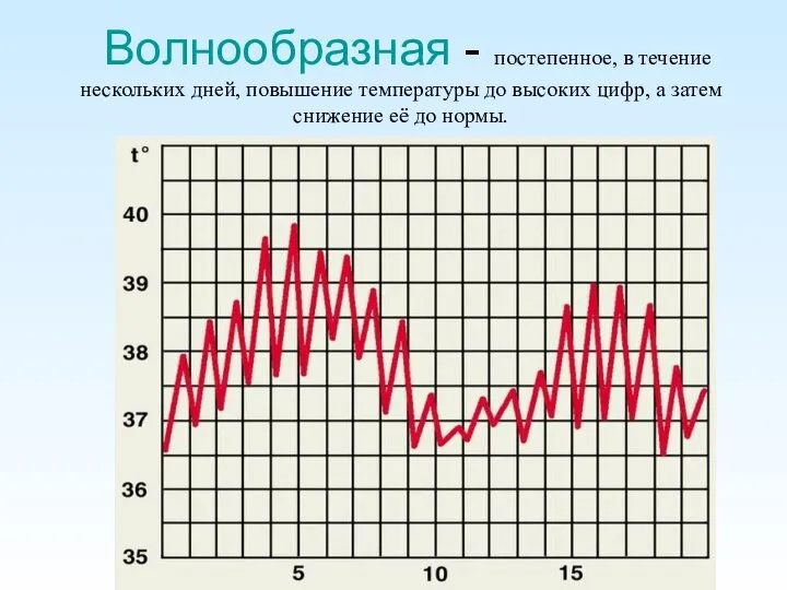 Волнообразная - постепенное, в течение нескольких дней, повышение температуры до высоких цифр,