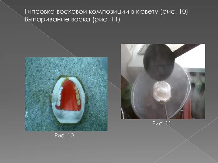 Гипсовка восковой композиции в кювету (рис. 10) Выпаривание воска (рис. 11) Рис. 10 Рис. 11