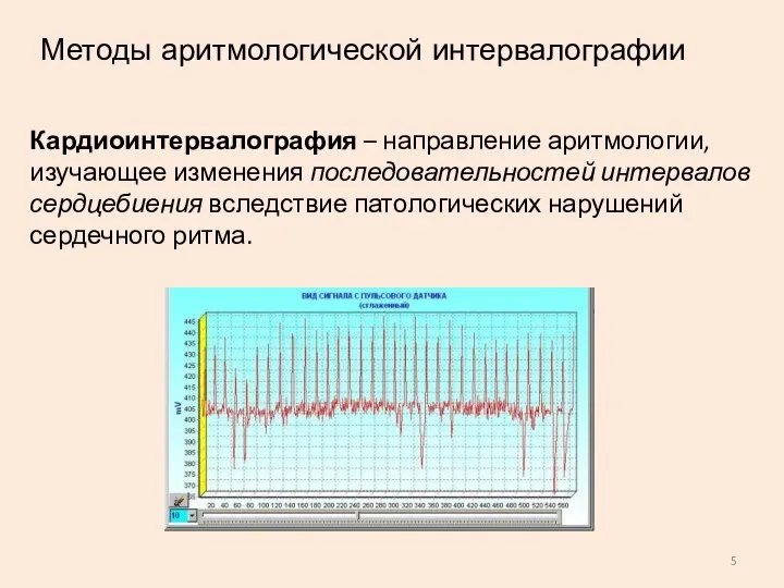 Кардиоинтервалография – направление аритмологии, изучающее изменения последовательностей интервалов сердцебиения вследствие патологических нарушений