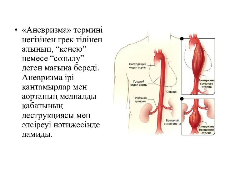 «Аневризма» термині негізінен грек тілінен алынып, “кеңею” немесе “созылу” деген мағына береді.Аневризма