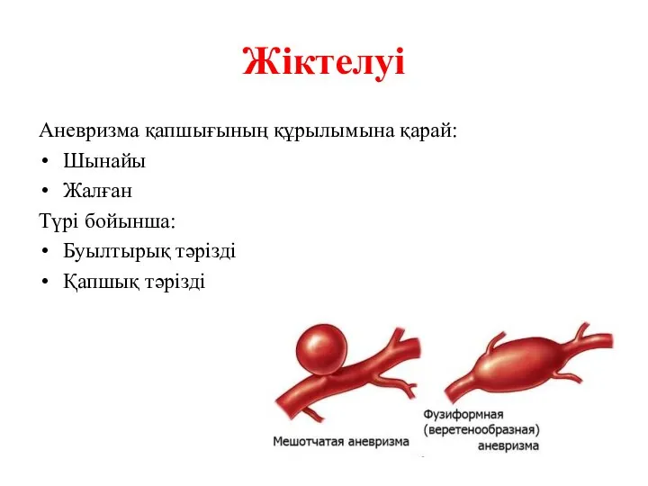 Жіктелуі Аневризма қапшығының құрылымына қарай: Шынайы Жалған Түрі бойынша: Буылтырық тәрізді Қапшық тәрізді