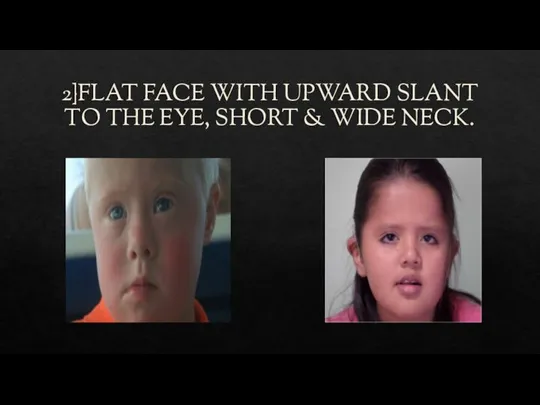 2}FLAT FACE WITH UPWARD SLANT TO THE EYE, SHORT & WIDE NECK.