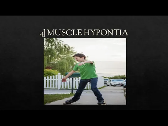 4} MUSCLE HYPONTIA