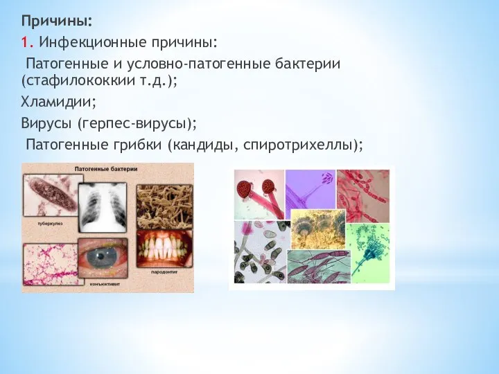 Причины: 1. Инфекционные причины: Патогенные и условно-патогенные бактерии (стафилококкии т.д.); Хламидии; Вирусы