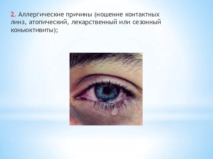 2. Аллергические причины (ношение контактных линз, атопический, лекарственный или сезонный коньюктивиты);