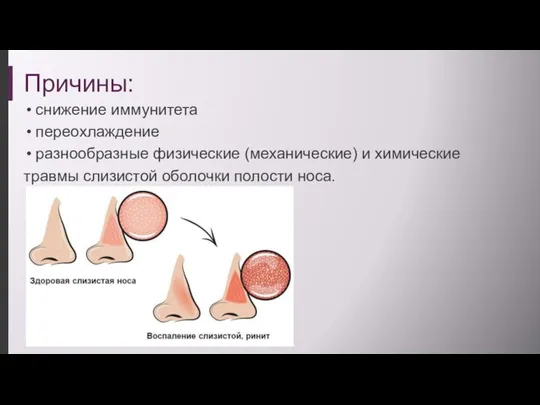 Причины: снижение иммунитета переохлаждение разнообразные физические (механические) и химические травмы слизистой оболочки полости носа.