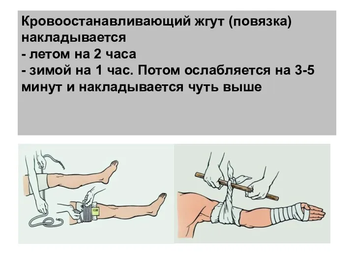 Кровоостанавливающий жгут (повязка) накладывается - летом на 2 часа - зимой на