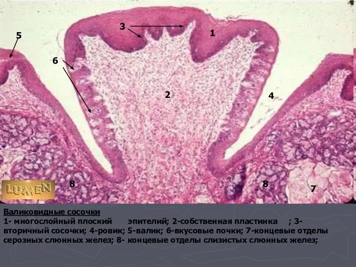 Валиковидные сосочки 1- многослойный плоский эпителий; 2-собственная пластинка ; 3-вторичный сосочки; 4-ровик;
