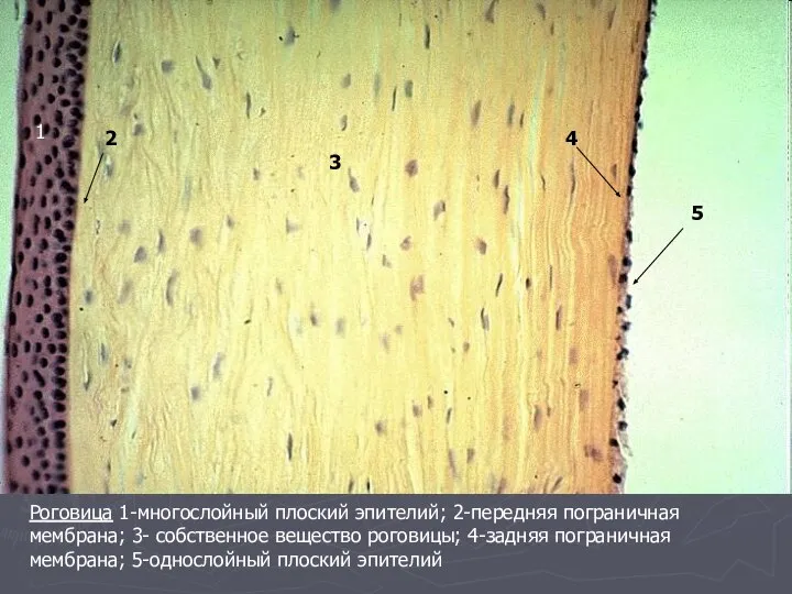 Роговица 1-многослойный плоский эпителий; 2-передняя пограничная мембрана; 3- собственное вещество роговицы; 4-задняя