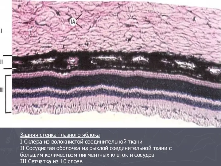 Задняя стенка глазного яблока I Склера из волокнистой соединительной ткани II Сосудистая