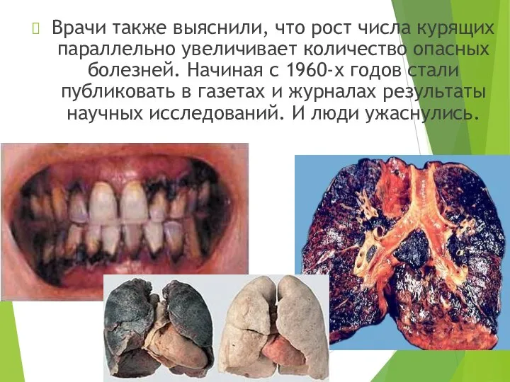 Врачи также выяснили, что рост числа курящих параллельно увеличивает количество опасных болезней.