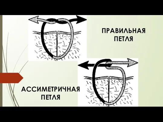 ПРАВИЛЬНАЯ ПЕТЛЯ АССИМЕТРИЧНАЯ ПЕТЛЯ