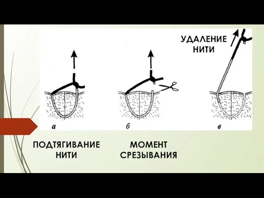 ПОДТЯГИВАНИЕ НИТИ МОМЕНТ СРЕЗЫВАНИЯ УДАЛЕНИЕ НИТИ