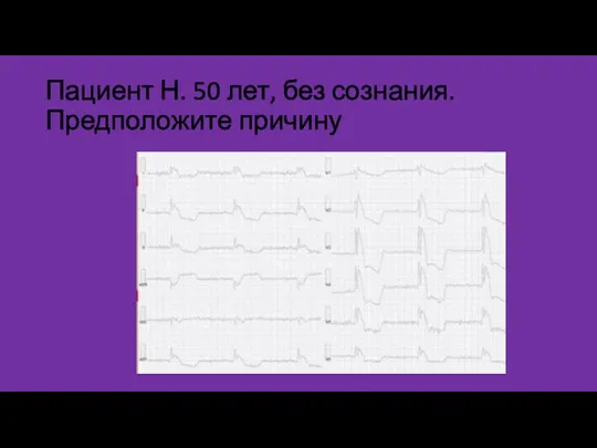 Пациент Н. 50 лет, без сознания. Предположите причину