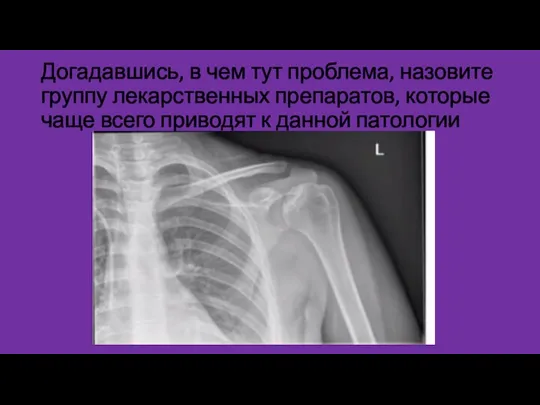 Догадавшись, в чем тут проблема, назовите группу лекарственных препаратов, которые чаще всего приводят к данной патологии