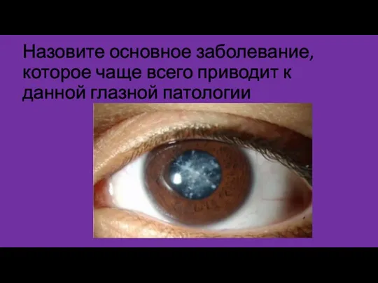 Назовите основное заболевание, которое чаще всего приводит к данной глазной патологии