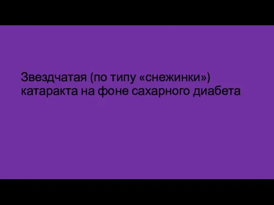 Звездчатая (по типу «снежинки») катаракта на фоне сахарного диабета