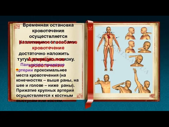 Временная остановка кровотечения осуществляется различными способами. Капиллярное и венозное кровотечение достаточно наложить